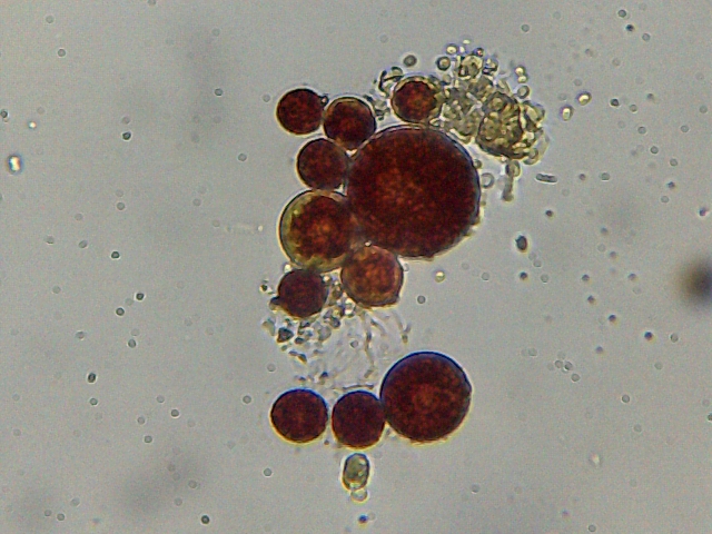 Haematococcus pluvialis e philodina